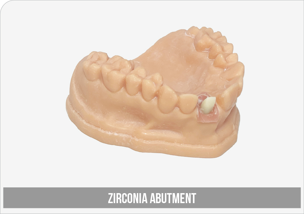 Zirconia Abutment